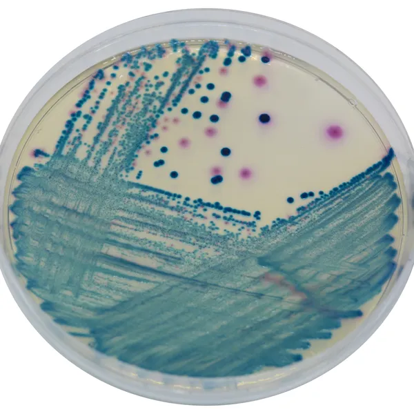 CHROMagar™ mSuperCARBA™