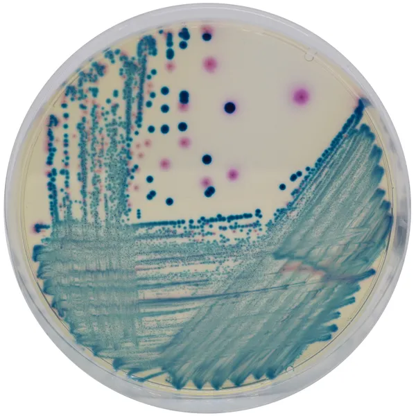 CHROMagar™ mSuperCARBA™