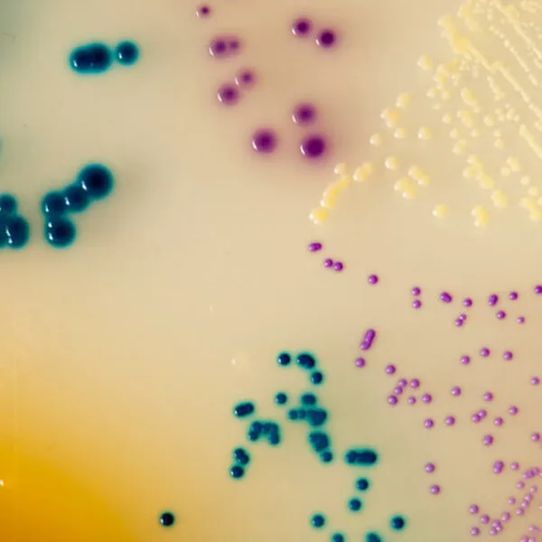 CHROMagar™ Orientation