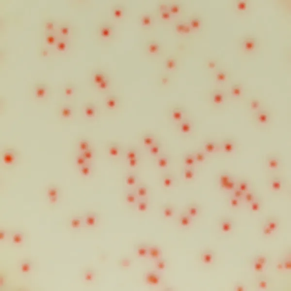 CHROMagar™ C. perfringens