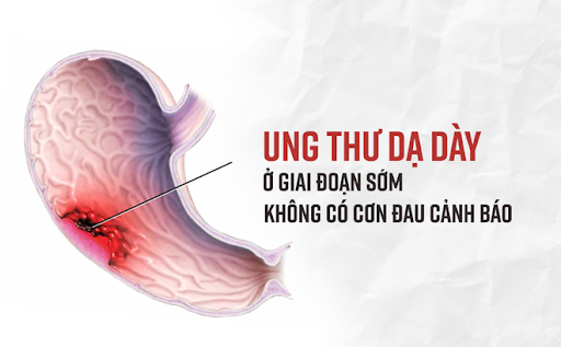 7. Phòng ngừa ung thư dạ dày