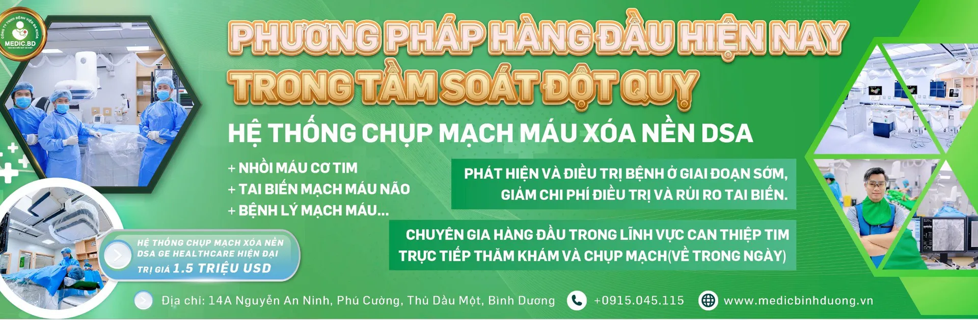 Hệ thống chụp mạch máu xóa nền DSA