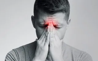 VIÊM XOANG DO NẤM: NGUYÊN NHÂN, TRIỆU CHỨNG, BIẾN CHỨNG VÀ CÁCH ĐIỀU TRỊ VIÊM XOANG DO NẤM: NGUYÊN NHÂN, TRIỆU CHỨNG, BIẾN CHỨNG VÀ CÁCH ĐIỀU TRỊ