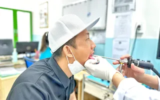 VIÊM HỌNG CẤP VIÊM HỌNG CẤP