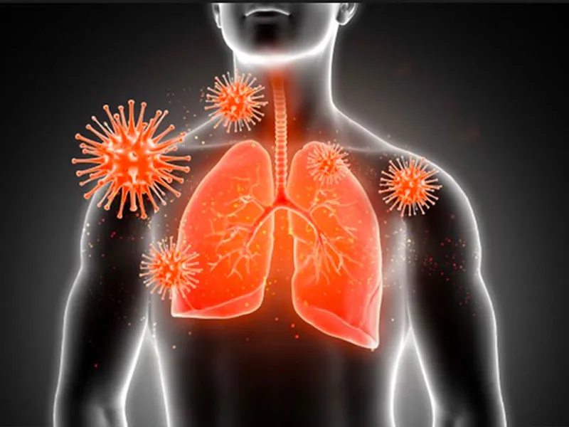 NHIỄM TRÙNG ĐƯỜNG HÔ HẤP: NGUYÊN NHÂN, TRIỆU CHỨNG, CÁCH PHÒNG NGỪA VÀ ĐIỀU TRỊ