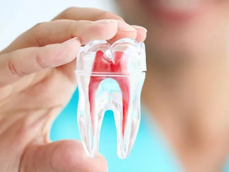 TRÁM RĂNG LẤY TỦY LÀ GÌ? TÁC HẠI, ƯU NHƯỢC ĐIỂM VÀ THỜI GIAN ĐIỀU TRỊ