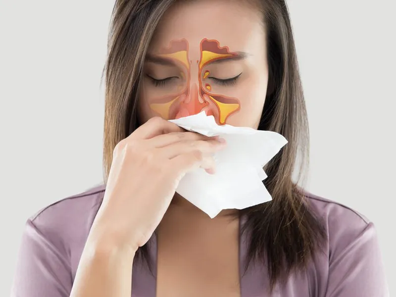NHIỄM TRÙNG XOANG CÓ NGUY HIỂM KHÔNG? DẤU HIỆU, BIẾN CHỨNG VÀ CÁCH ĐIỀU TRỊ
