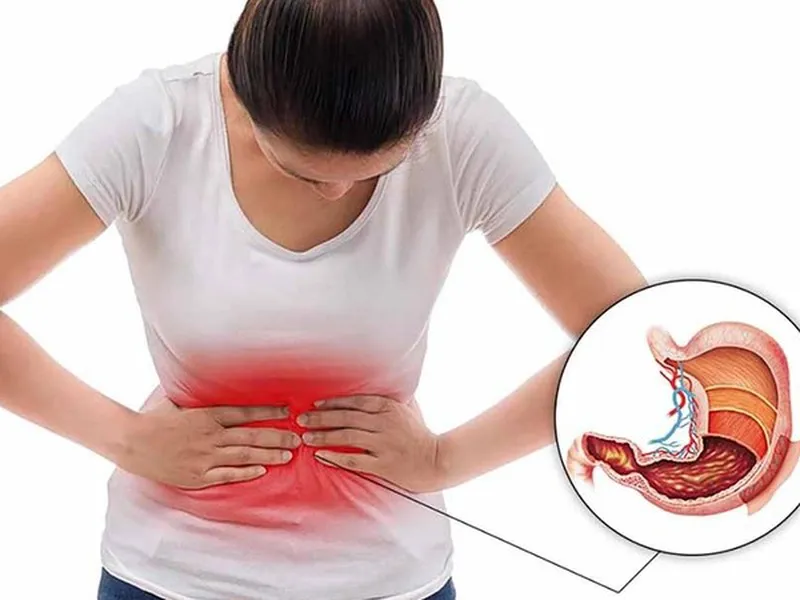 VIÊM LOÉT DẠ DÀY: NGUYÊN NHÂN, TRIỆU CHỨNG, BIẾN CHỨNG VÀ CÁCH PHÒNG TRÁNH