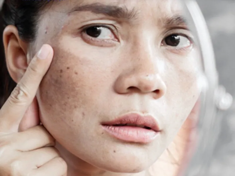 ĐỒI MỒI Ở NGƯỜI TRẺ: NGUYÊN NHÂN, DẤU HIỆU, CÁCH ĐIỀU TRỊ VÀ PHÒNG NGỪA HIỆU QUẢ