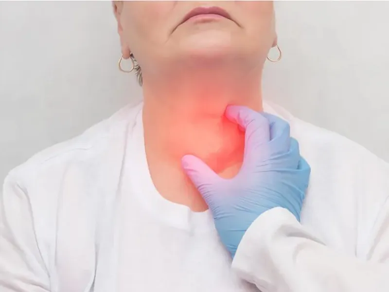 BƯỚU CỔ Ở NỮ GIỚI LÀ GÌ? NGUYÊN NHÂN, TRIỆU CHỨNG VÀ CÁCH PHÒNG NGỪA