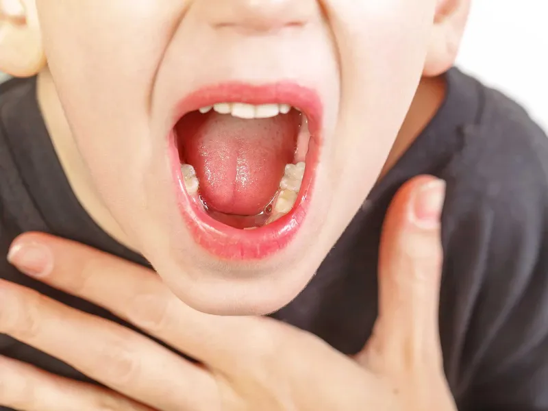 VIÊM V.A:  NGUYÊN NHÂN, TRIỆU CHỨNG, VÀ CÁCH PHÒNG NGỪA HIỆU QUẢ