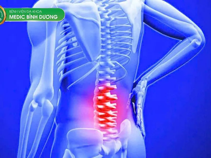ĐAU LƯNG DAI DẲNG VÀ CHẨN ĐOÁN ĐỘT PHÁ
