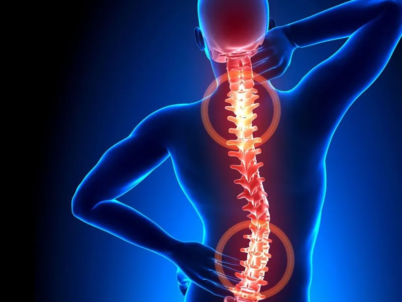 THOÁT VỊ ĐĨA ĐỆM: NGUYÊN NHÂN, TRIỆU CHỨNG VÀ PHƯƠNG PHÁP PHÒNG NGỪA HIỆU QUẢ