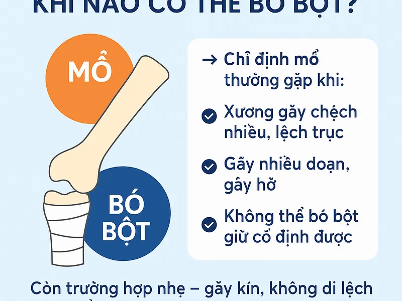GÃY XƯƠNG – KHI NÀO CẦN MỔ, KHI NÀO CÓ THỂ BÓ BỘT?