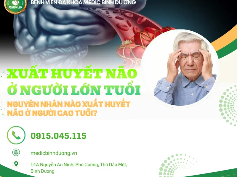 XUẤT HUYẾT NÃO Ở NGƯỜI CAO TUỔI: NGUYÊN NHÂN, TRIÊU CHỨNG VÀ CÁCH PHÒNG NGỪA