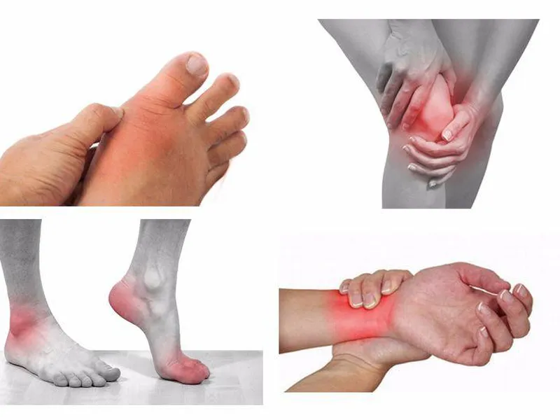 CÁC THỰC PHẨM NGƯỜI BỆNH VIÊM KHỚP CẦN TRÁNH XA