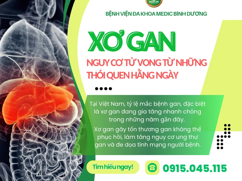 XƠ GAN LÀ GÌ? DẤU HIỆU CẢNH BÁO VÀ BIẾN CHỨNG NGUY HIỂM