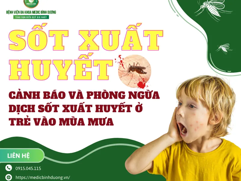 SỐT XUẤT HUYẾT Ở TRẺ EM