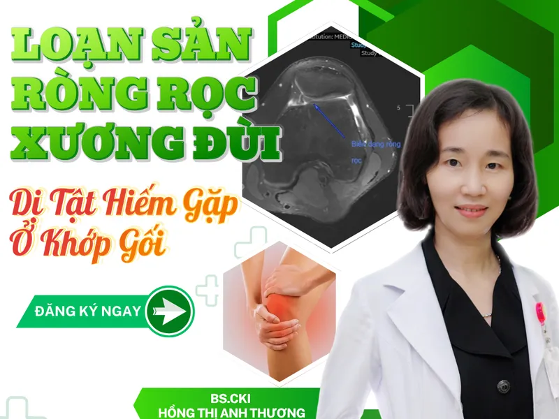 LOẠN SẢN RÒNG RỌC XƯƠNG ĐÙI: NHẬN DIỆN, ĐIỀU TRỊ VÀ PHỤC HỒI CHỨC NĂNG