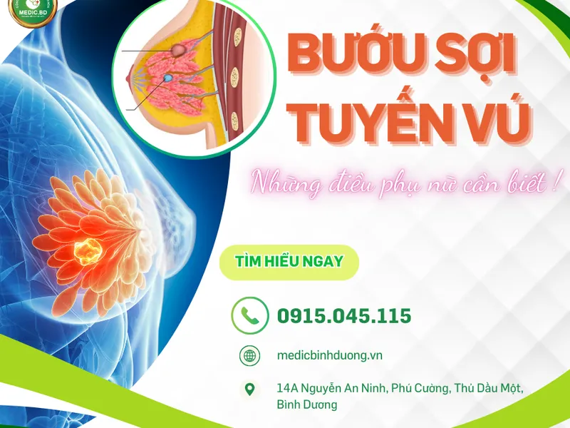 BƯỚU SỢI TUYẾN VÚ CÓ NGUY HIỂM KHÔNG? NGUYÊN NHÂN, TRIỆU CHỨNG VÀ CÁCH ĐIỀU TRỊ