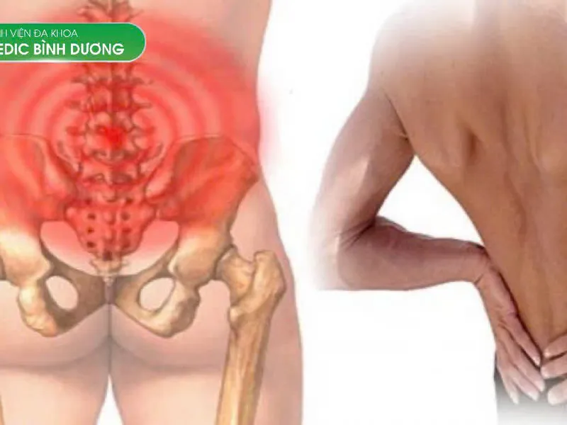 ĐAU LƯNG DƯỚI LÀ BỆNH GÌ? TRIỆU CHỨNG, PHÂN LOẠI VÀ CÁCH CHỮA TRỊ