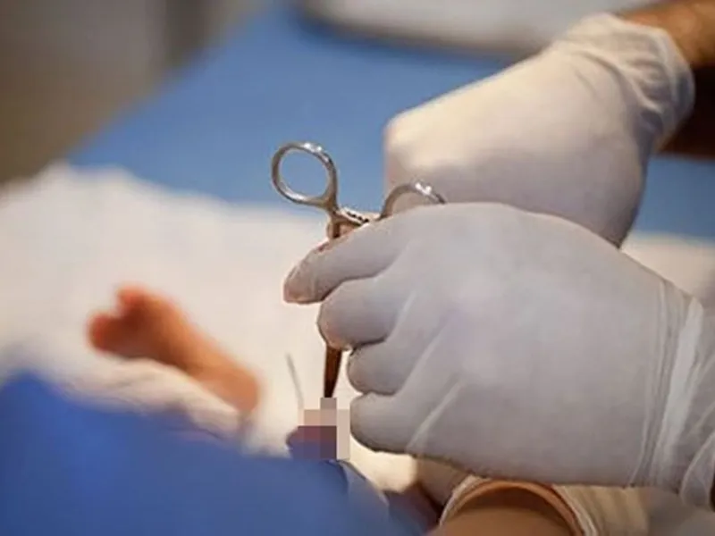 CẮT BAO QUY ĐẦU CÓ ẢNH HƯỞNG ĐẾN SỨC KHỎE NAM GIỚI KHÔNG?