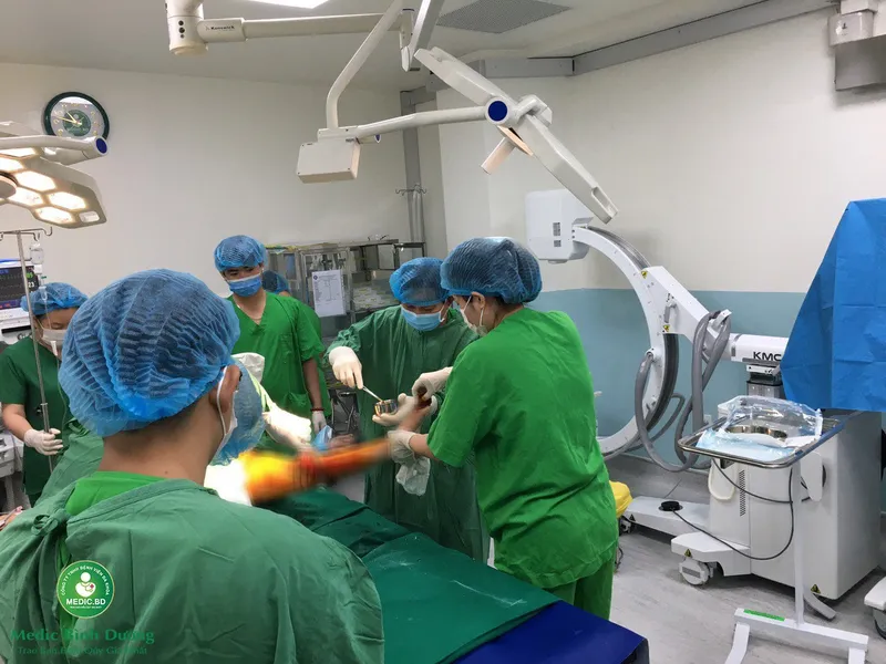 PHẪU THUẬT KẾT HỢP XƯƠNG ĐÙI BẰNG NẸP VIS