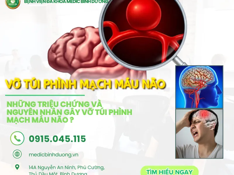 TÚI PHÌNH MẠCH MÁU NÃO: DẤU HIỆU CẢNH BÁO, NGUYÊN NHÂN VÀ PHƯƠNG PHÁP ĐIỀU TRỊ