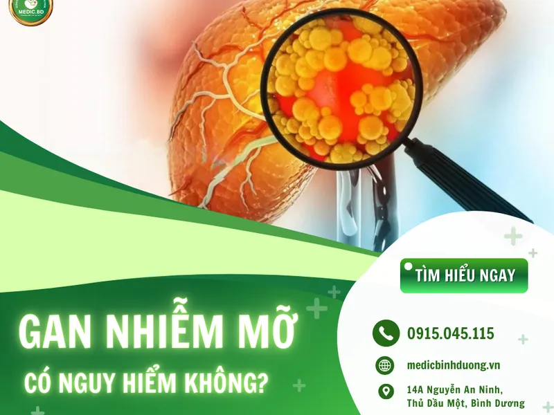 GAN NHIỄM MỠ: DẤU HIỆU, NGUYÊN NHÂN VÀ CÁCH PHÒNG NGỪA HIỆU QUẢ