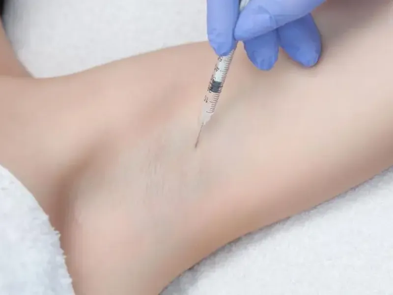 GIẢI PHÁP CHO MỒ HÔI NÁCH CÓ MÙI