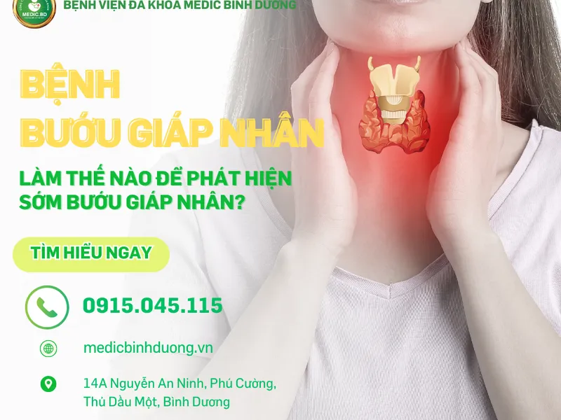 BƯỚU GIÁP NHÂN LÀ GÌ? TRIỆU CHỨNG, NGUYÊN NHÂN VÀ CÁCH PHÒNG NGỪA