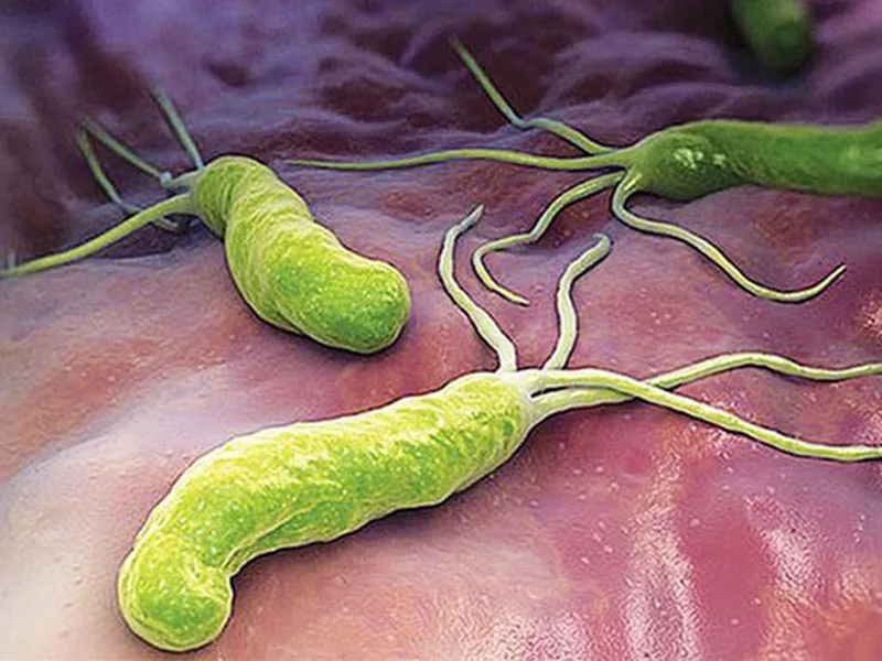 NHIỄM  HELICOBACTER PYLORY TRONG DẠ DÀY - XÉT NGHIỆM HƠI THỞ CHẨN ĐOÁN BỆNH