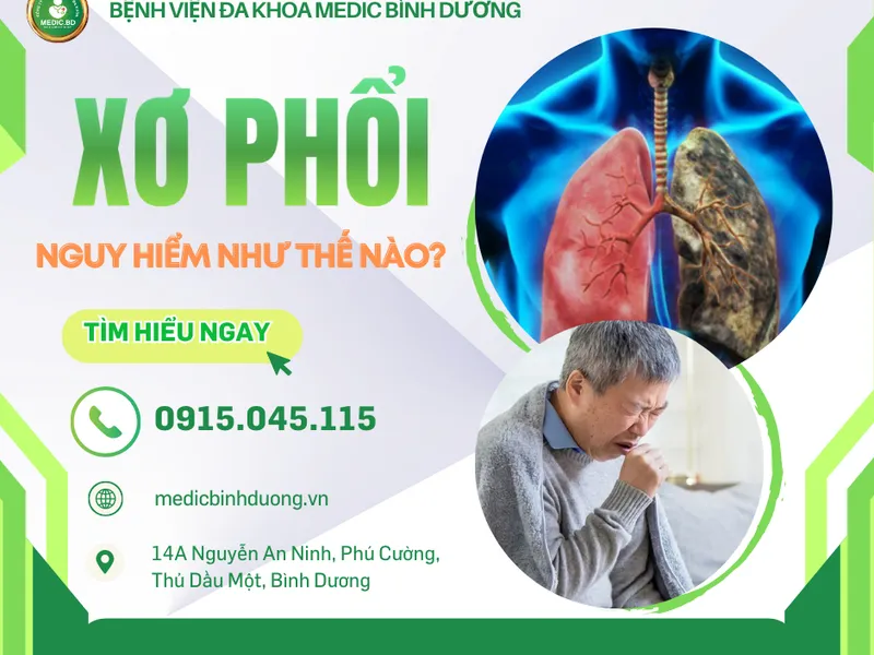 BỆNH XƠ PHỔI: NGUY HIỂM THẾ NÀO? TRIỆU CHỨNG, NGUYÊN NHÂN VÀ CÁCH ĐIỀU TRỊ