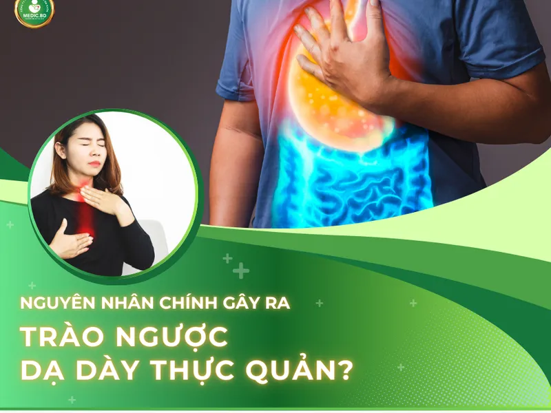 TRÀO NGƯỢC DẠ DÀY THỰC QUẢN: TRIỆU CHỨNG, NGUYÊN NHÂN VÀ CÁCH PHÒNG NGỪA HIỆU QUẢ