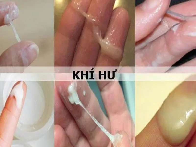 KHÍ HƯ LÀ GÌ? PHÂN BIỆT KHÍ HƯ BÌNH THƯỜNG VÀ KHÍ HƯ BẤT THƯỜNG NHƯ THẾ NÀO?