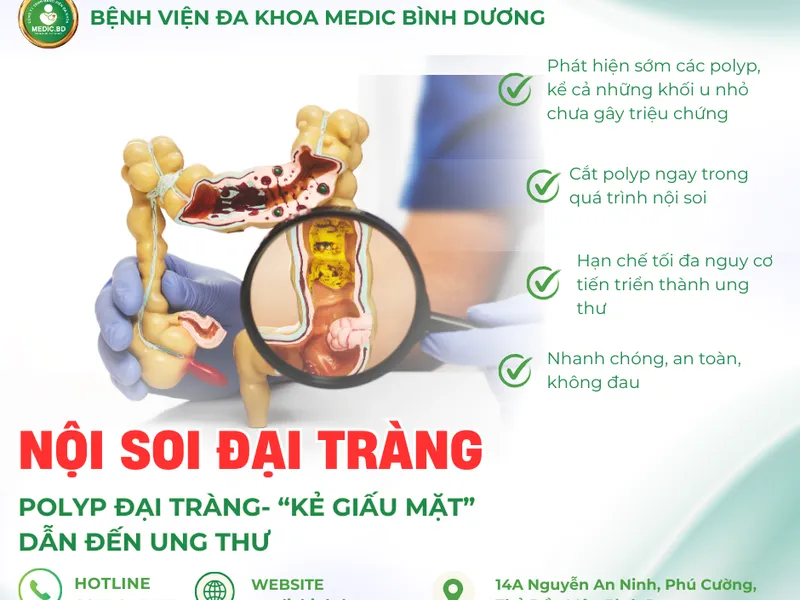 CẮT POLYP ĐẠI TRÀNG BẰNG NỘI SOI: PHƯƠNG PHÁP HIỆU QUẢ & AN TOÀN NHẤT HIỆN NAY