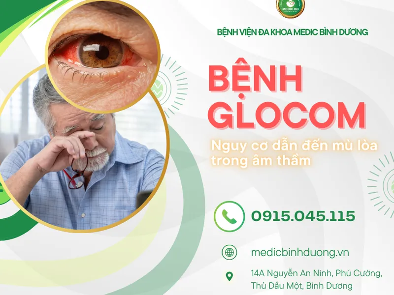 GLOCOM LÀ GÌ? NGUYÊN NHÂN, TRIỆU CHỨNG VÀ CÁCH PHÒNG NGỪA HIỆU QUẢ