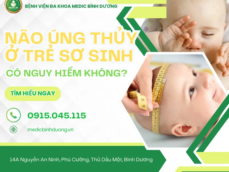 NÃO ÚNG THỦY Ở TRẺ SƠ SINH: DẤU HIỆU, NGUYÊN NHÂN, BIẾN CHỨNG VÀ CÁCH PHÒNG NGỪA