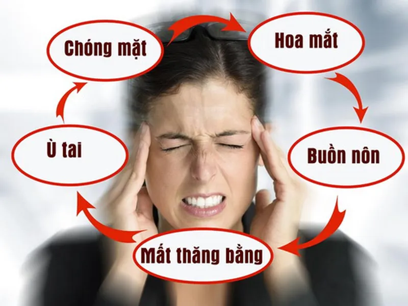 PHƯƠNG PHÁP CHỮA RỐI LOẠN TIỀN ĐÌNH BẰNG ĐÔNG Y