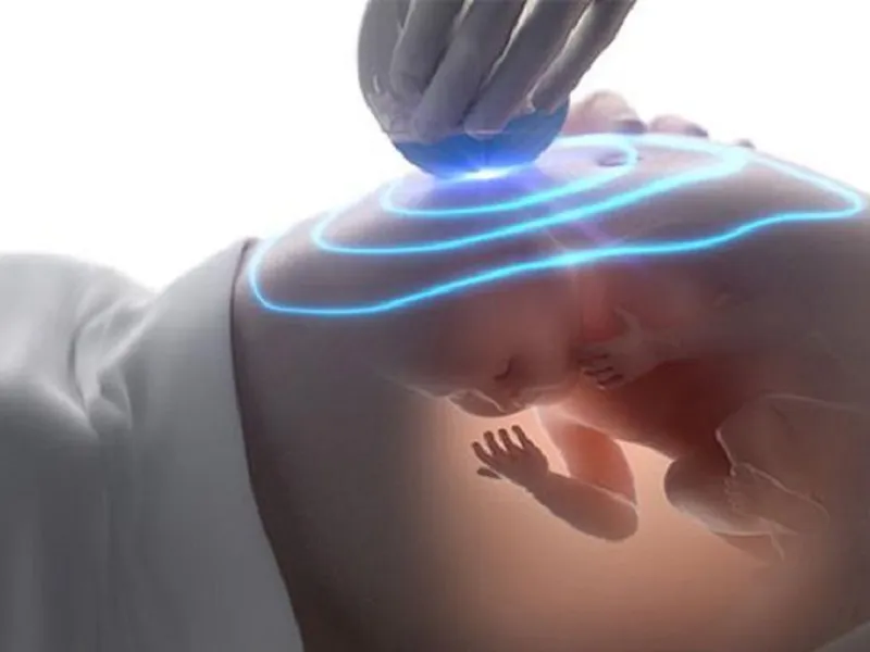 LỢI ÍCH CỦA VIỆC SIÊU ÂM MÀU DOPPLER