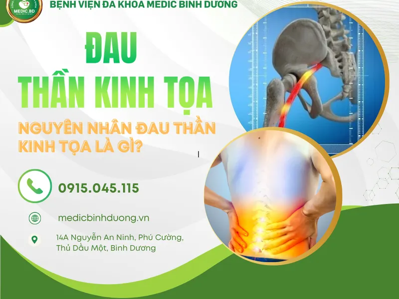ĐAU THẦN KINH TỌA: NGUYÊN NHÂN, TRIỆU CHỨNG VÀ CÁCH ĐIỀU TRỊ HIỆU QUẢ