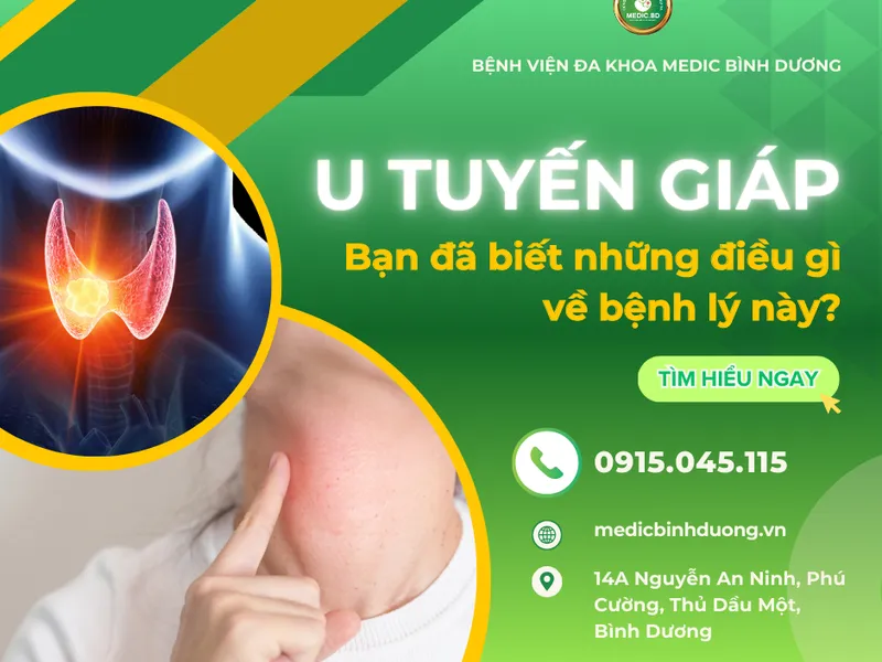 U TUYẾN GIÁP: NGUYÊN NHÂN, TRIỆU CHỨNG VÀ PHƯƠNG PHÁP PHÒNG NGỪA