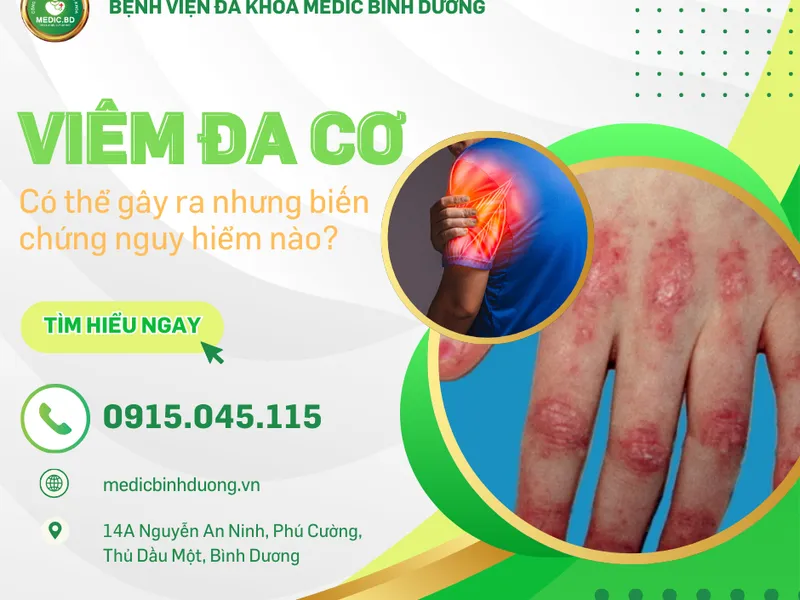 VIÊM ĐA CƠ LÀ GÌ? TRIỆU CHỨNG VÀ NHỮNG NGUY CƠ NGUY HIỂM CẦN BIẾT