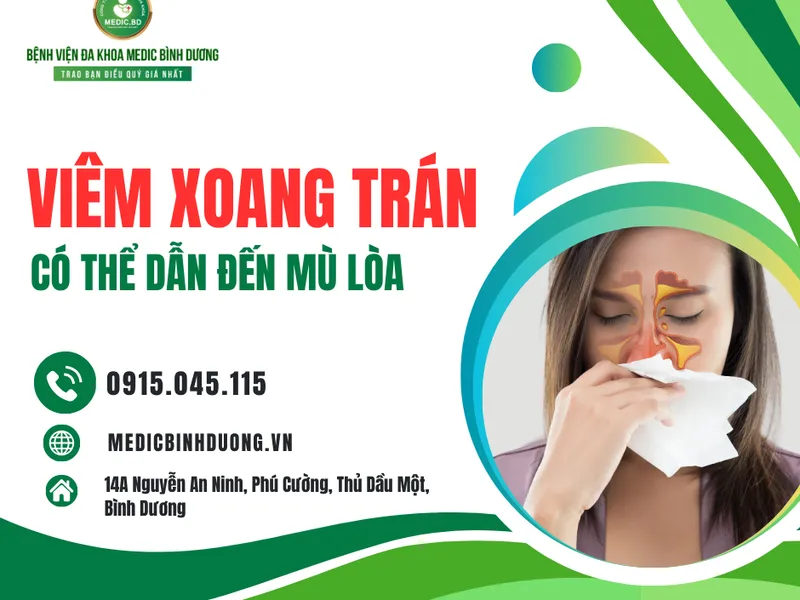 VIÊM XOANG TRÁN CÓ THỂ DẪN ĐẾN MÙ LÒA