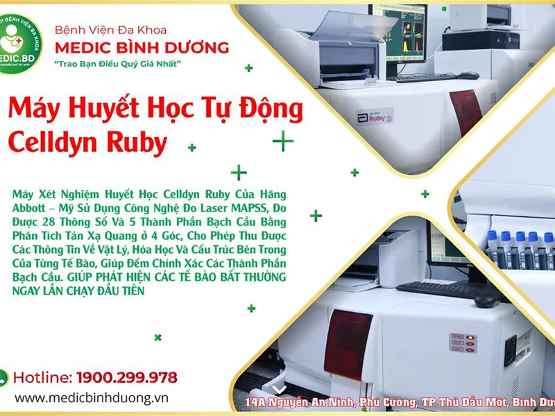 MÁY XÉT NGHIỆM HUYẾT HỌC CELLDYN RUBY