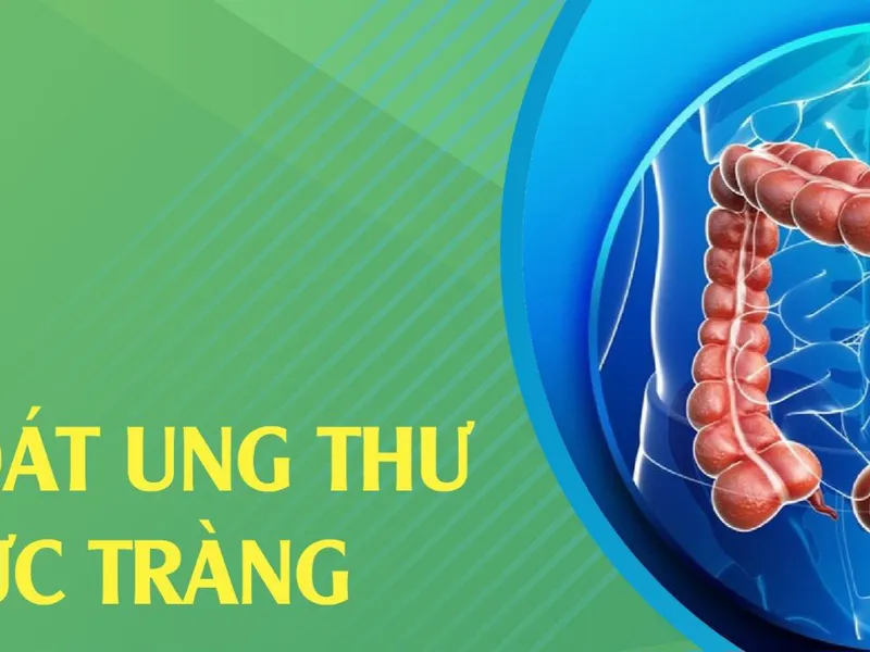 GÓI KHÁM DỊCH VỤ TẦM SOÁT UNG THƯ ĐẠI TRỰC TRÀNG