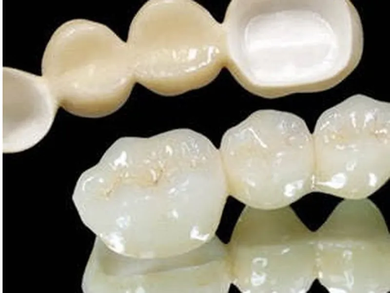 RĂNG SỨ ZIRCONIA TRONG NHA KHOA