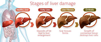 toi-den-va-bao-ve-gan toi-den-va-bao-ve-gan