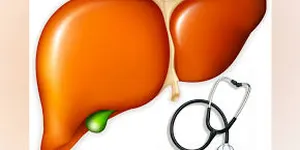 Tỏi đen và giúp bảo vệ gan