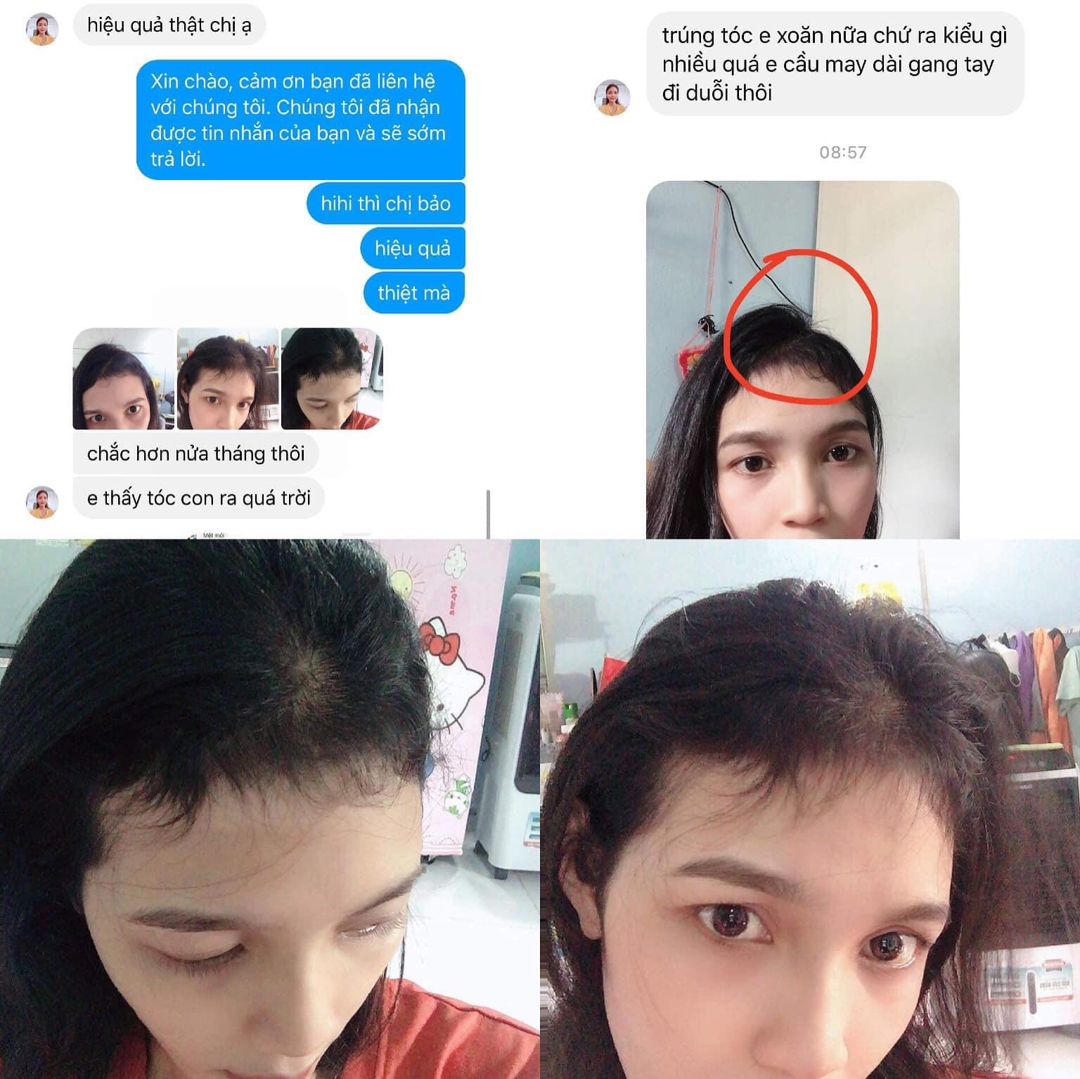 xit toc tue vi xit toc tue vi